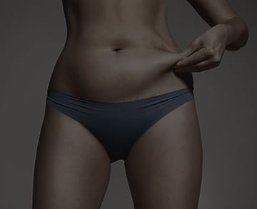 Liposuction model 01, Dr Reddy Sydney & Central COast